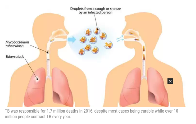 All India Radio Air Ias Upsc Eradication Of Tb By 25 From India Iasbaba