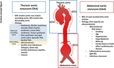 ascending thoracic aortic aneurysm